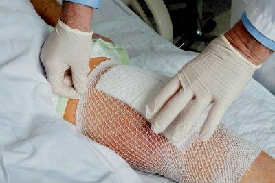 Ã¯Â¿Â½QUE SUCEDE DESPUES DE LA CIRUGIA DE PROTESIS DE RODILLA?, DRA MAZZOGLIO TERESA, Venado Tuerto